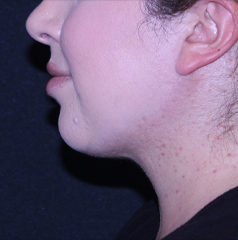 B&A